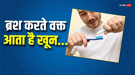 ब्रश करते वक्त आपके दांतों से भी आता है खून जानें इसकी वजह और इससे बचने के उपाय