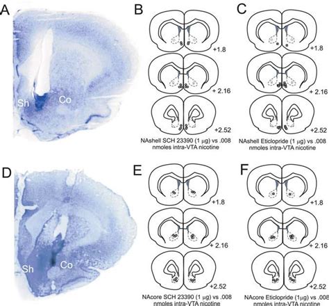 Histological Analysis Of Nacore Versus Nashell Microinfusion Cannula