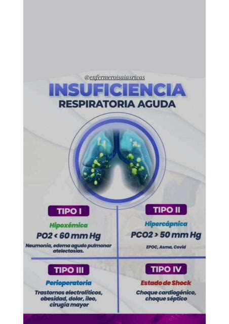 Insuficiencia Respiratoria Aguda Enfermero Isaias Rivas