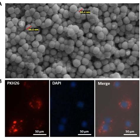 Characterization And Cellular Uptake Of Ovarian Cancer Cell Derived