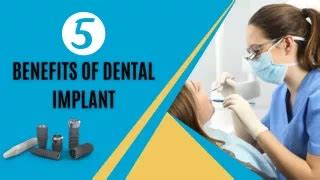 Ppt Top Benefits Of Dental Veneers Powerpoint Presentation Free