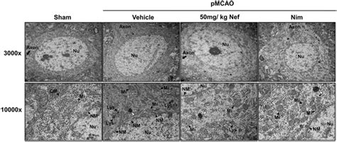 Transmission Electron Micrographs Of Neuronal Cells From The Right