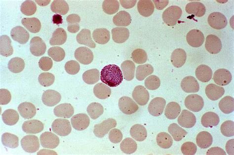 Plasmodium Vivax Morfologia Ciclo De Vida E Sintomas Biologia 2024