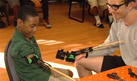 UF students give Palm Beach teen 3-D printed prosthetic limbs - WSVN ...