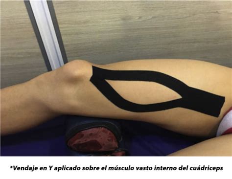 Efectos Del Kinesiotaping En La Funci N De La Rodilla Y En El Dolor En