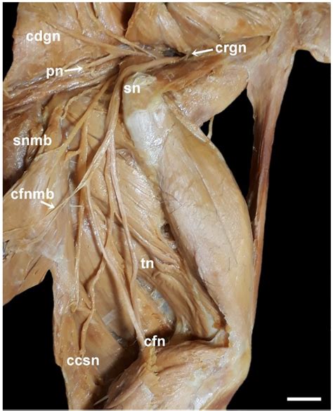 Scielo Brasil The Lumbosacral Plexus In Two Didelphis Species