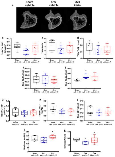 Ijms Free Full Text Irisin Protects Against Loss Of Trabecular Bone