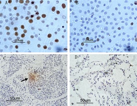 Immunocytochemistry Staining In Cells And Immunohistochemical Staining