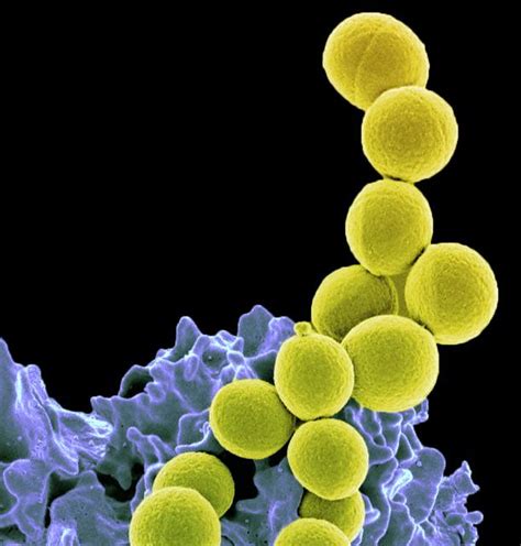 Methicillin Resistant Staphylococcus Aureus Bacteria Flickr