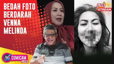 LIVE PAKAR TELEMATIKA FOTO VENNA MELINDA BERLUMURAN DARAH YouTube