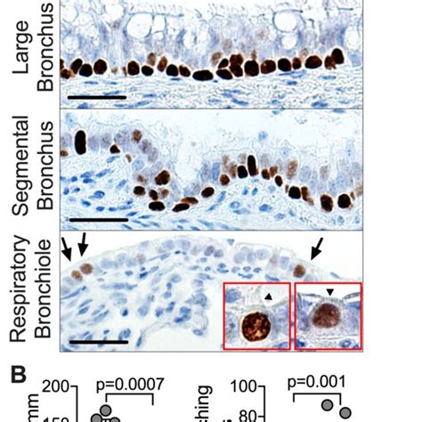 CFTR Expression In Airway Surface Epithelia Of CFTR Pigs A