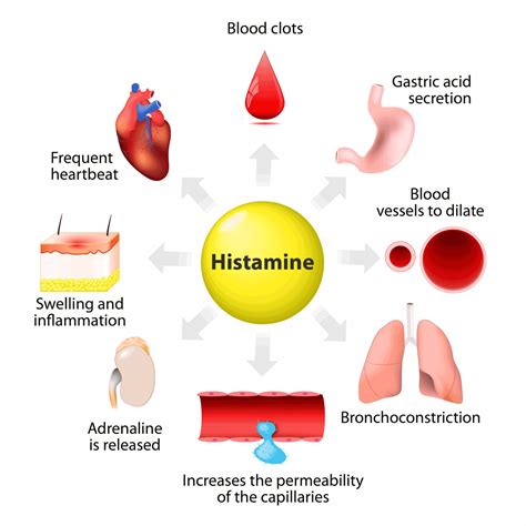 Effective Treatment for Histamine Intolerance - IBS Clinics