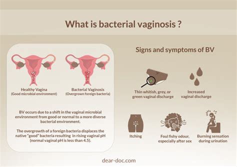 Understanding Bacterial Vaginosis Ask The Nurse Expert