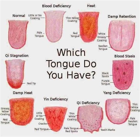 Things Your Tongue Is Trying Tongue Health Tongue Sores Tongue Problems