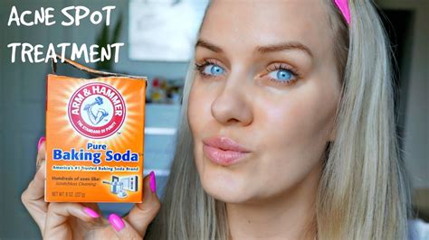 How To Get Rid Of Acne Using Baking Soda Spot Treatment In 5 Days