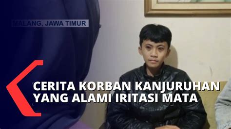 Begini Cerita Salah Satu Korban Kanjuruhan Yang Terkena Efek Gas Air