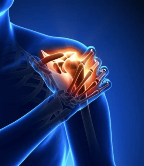 Upper Extremity Injury Town Center Orthopaedics