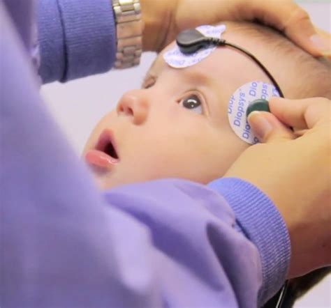 Enfant Pediatric Visual Evoked Potential Vep Vision Test