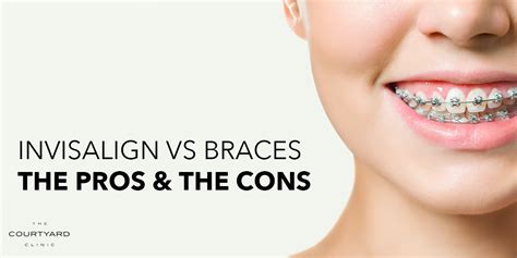 Pros And Cons Of Invisalign Vs Traditional Braces Leaver Gardner