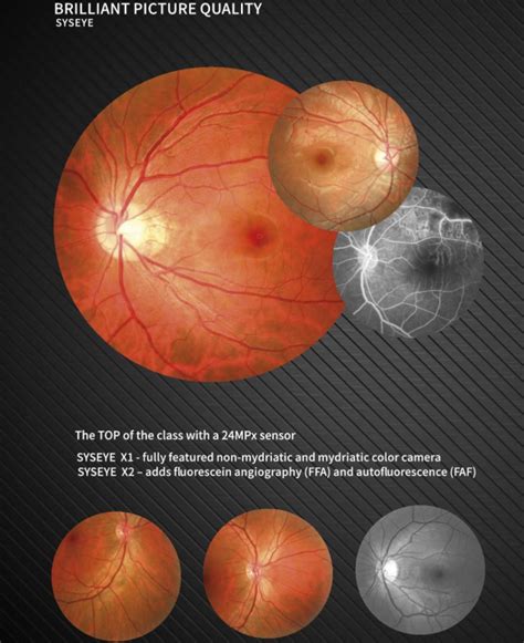 Digital Fundus Photography Camera Machine 35mm Effective Management Of