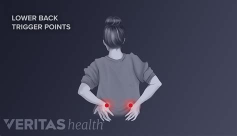 Axial Back Pain Most Common Low Back Pain Spine Health