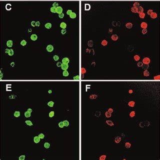 Disruption Of Actin Cytoskeleton In High Five Cells Expressing Glc