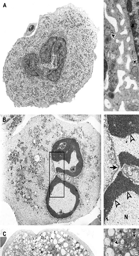 Ultrastructure Of Megakaryocytes In Healthy Controls And Itp