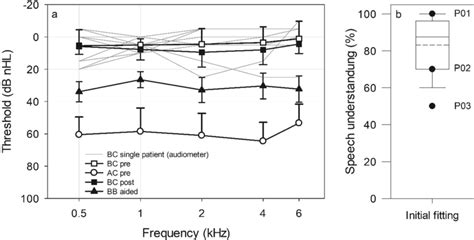 Displayed Are A Preoperative Air Conduction Ac And Bone Conduction Download Scientific