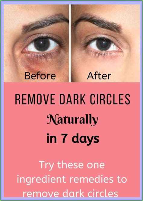 Remove Dark Circles Under Eyes Naturally In 3 Days How To Get Rid Of Dark Circles Permanently