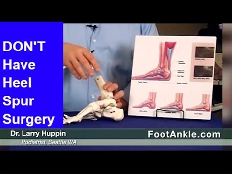 Foot & Ankle Center of Washington — Heel Spur Treatment – How to Avoid Heel Spur...