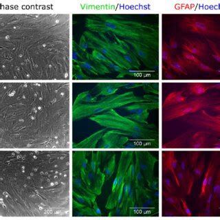 Expression Of Neural Markers In HNSCs Neuronally Differentiated For 4