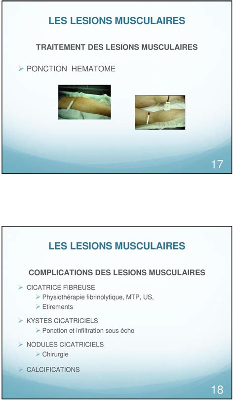 Tendinites et lésions musculaires PDF Free Download