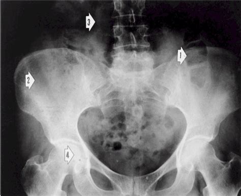 Introduction To Diagnostic Imaging Flashcards Quizlet