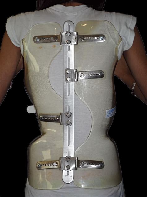 Pin By Richard Hinderberger On Korsett Orthopedic Brace Milwaukee