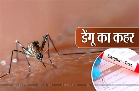 Dengue Spreading Rapidly Again In Bhopal Know Present Condition फिर