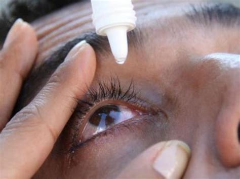 Incrementa Casos De Conjuntivitis Y Se Agota Medicamentos En Tabasco