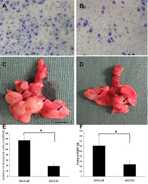 Detection Of The Metastatic Potential Of Sacc Lm And Sacc Cells