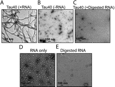 Cryo EM Structure Of RNA Induced Tau Fibrils Reveals A Small C Terminal