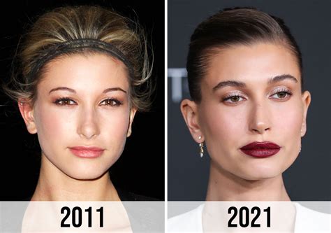 Hailey Bieber Plastic Surgery The Evolution Of Beauty