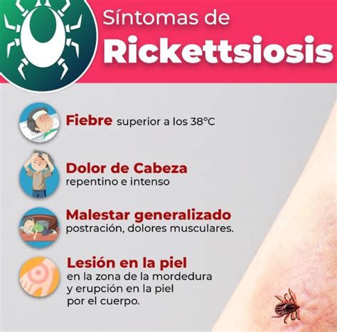 Van 8 Casos De Rickettsiosis En Coahuila Noticieros GREM