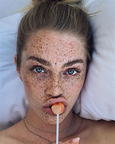 🌙 Swantje Paulina On Instagram “🍭 Freckles Going Crazyyy” Beautiful