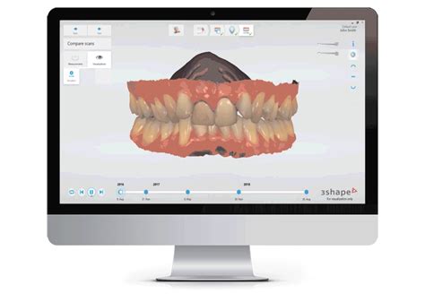 Dental Scan 3shape Trios West Byfleet Dental And Implant Centre