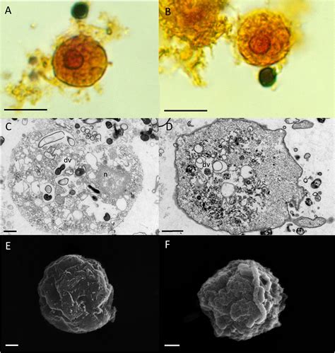 Entamoeba Gingivalis Life Cycle