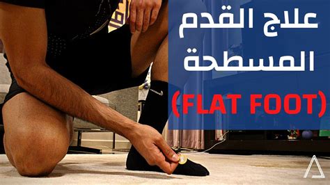 علاج الرجل المسطحة تمارين علاج للقدم المسطحة Flat Foot Treatment