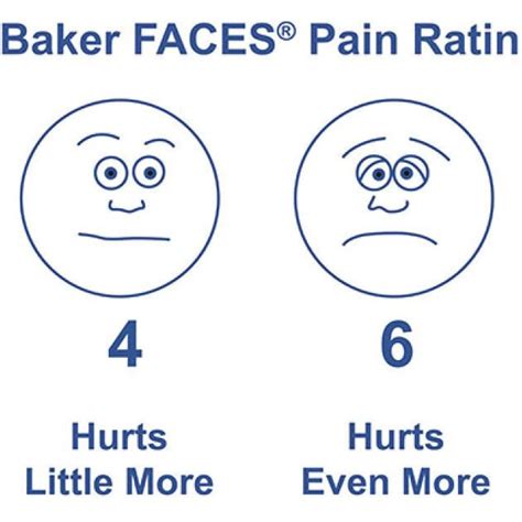 Wong-Baker FACES® Pain rating scale. | Download Scientific Diagram