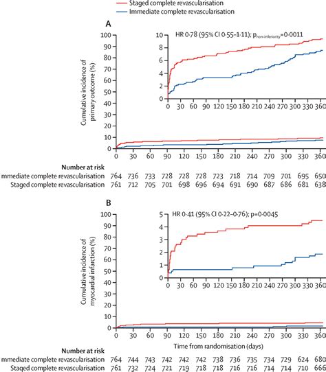 Immediate Versus Staged Complete Revascularisation In Patients