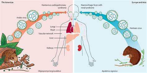 Hantavirus In Humans A Review Of Clinical Aspects And Management The