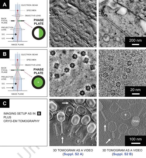 Scanning Electron Microscopy Contrast