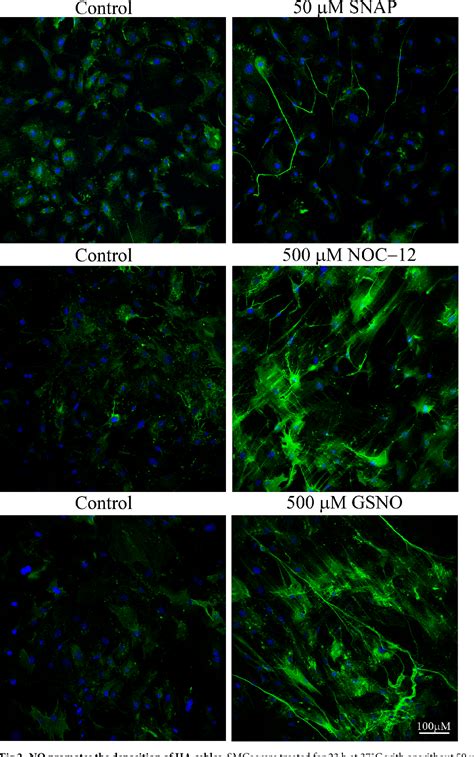 Figure From Nitric Oxide Alters Hyaluronan Deposition By Airway