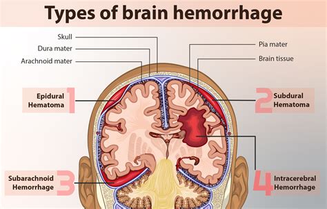 Meninges Of The Brain Diagram